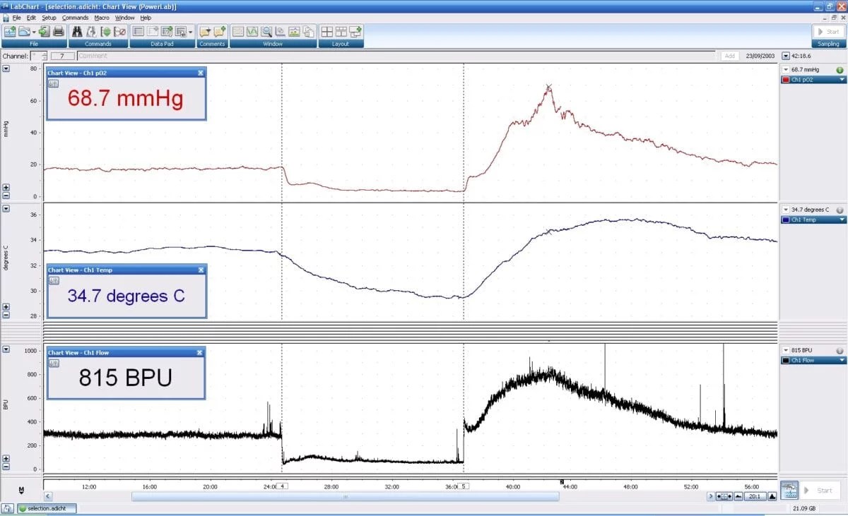 Combo Oxygen & Tissue Blood Perfusion [Oxford Optronix] Scintica