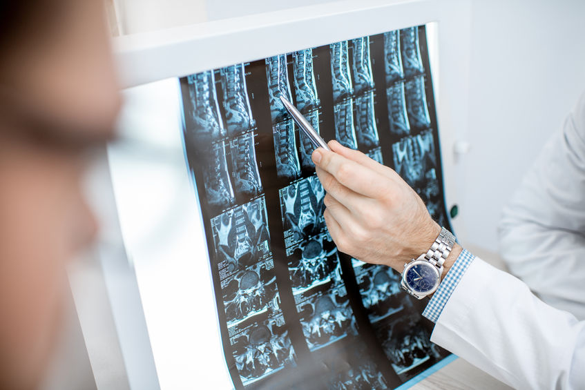 Can Scoliosis & Gymnastics Go Together? Scoliosis Therapy Centers