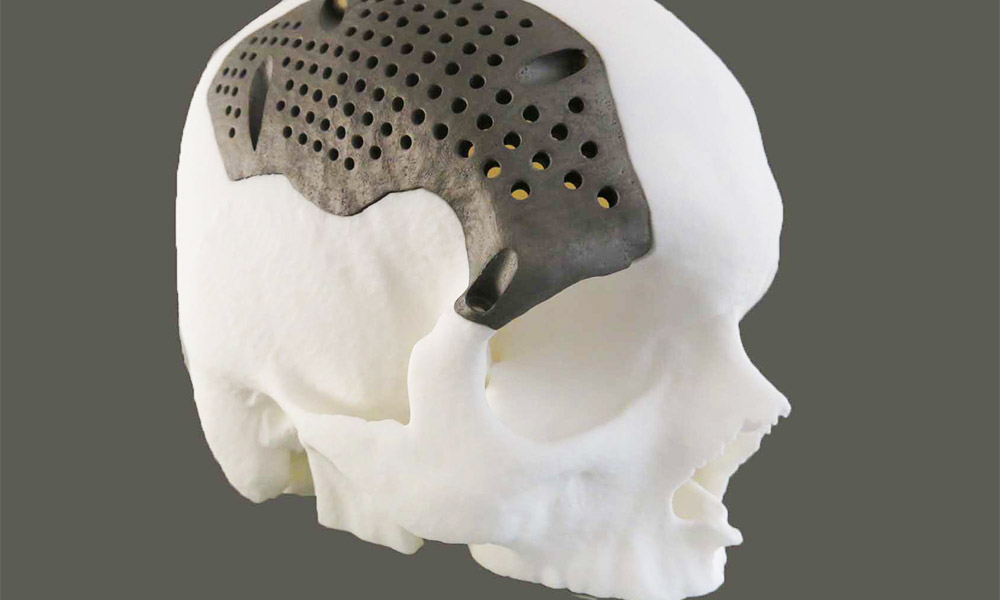 Discover 7 of the coolest metal 3D printing applications! Sculpteo Blog