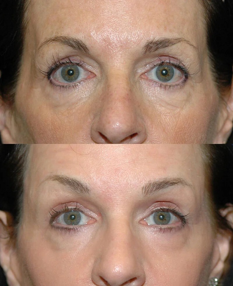 Understanding The Aging Face Seattle Face & Skin