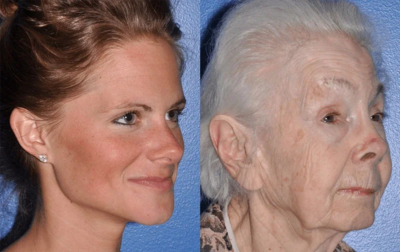 Understanding The Aging Face Seattle Face & Skin