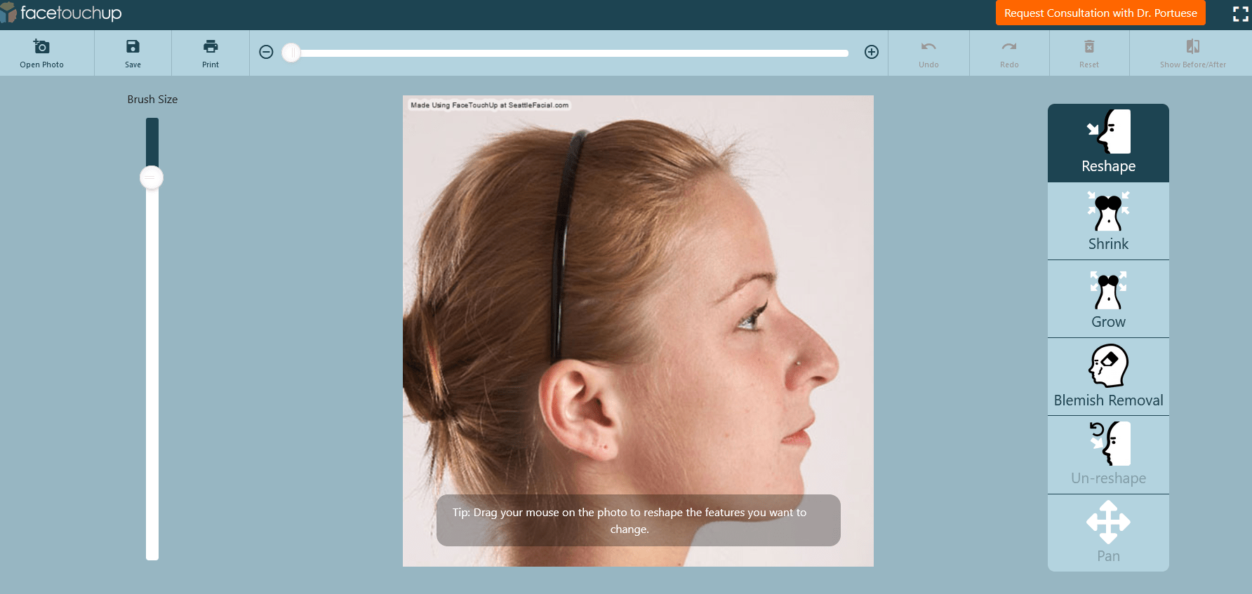 Virtual Rhinoplasty Virtual Rhinoplasty Tool