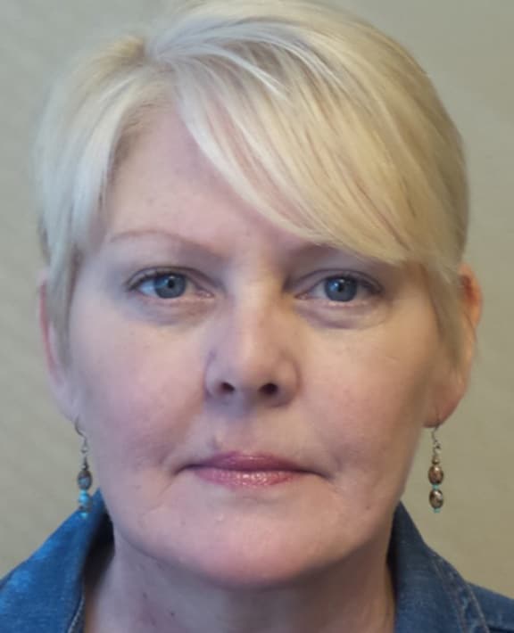 The Only Guide to Eyelid Lift Bellevue Blepharoplasty Seattle