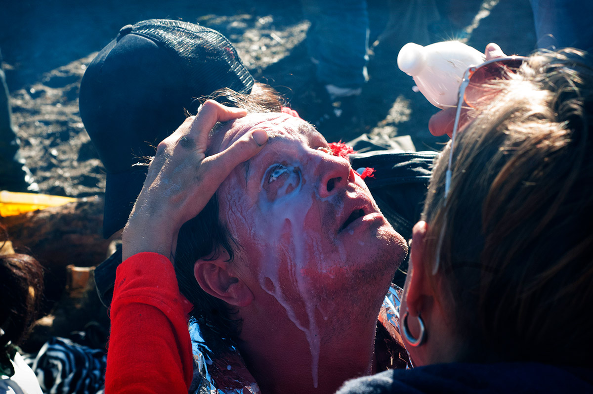 First Aid For Pepper Spray Exposure 15 Helpful Tips SecurityStore