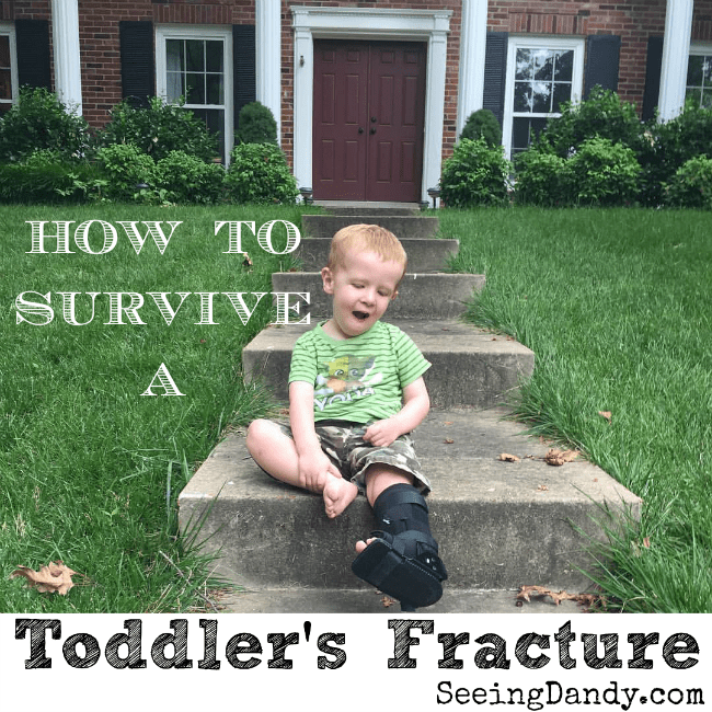 How To Survive A Toddler Fracture During Summer Seeing Dandy Blog