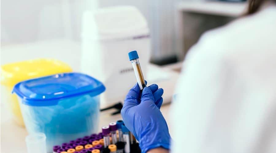 A Little Known Side Effect Of IUDs Copper Toxicity