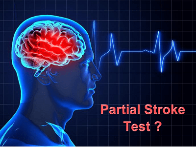 PST - Partial Stroke Test - Selemark
