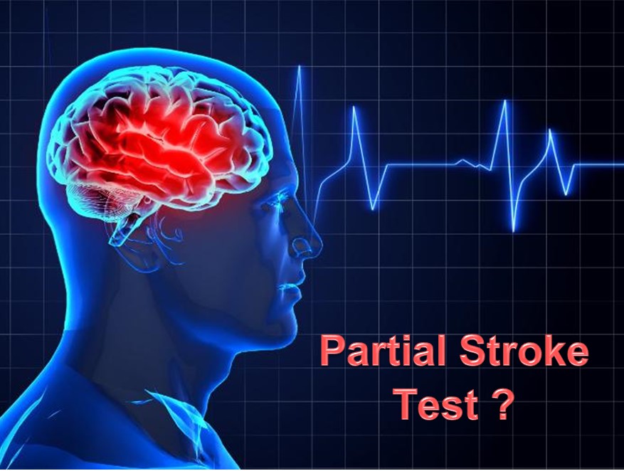 PSt Partial stroke testing for Emergency Shut Down Valve