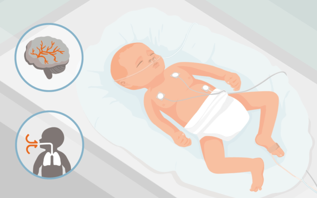 Transcutaneous Monitoring in the NICU Sentec