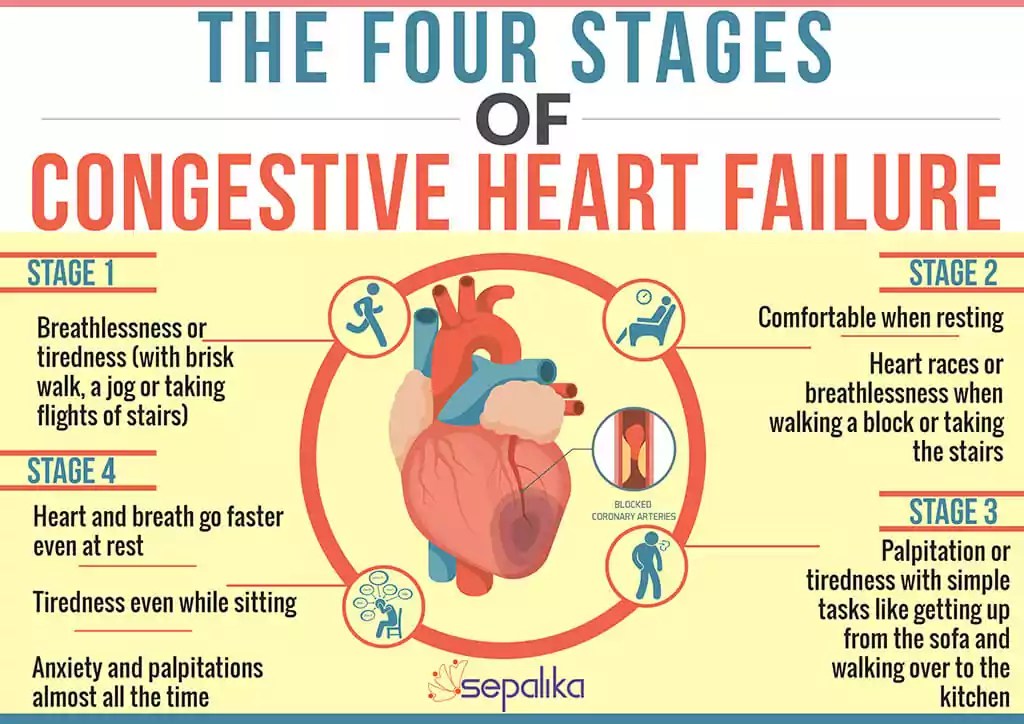 Congestive Heart Failure (CHF) Symptoms, Stages, Life Expectancy
