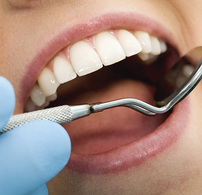 PeriodontistSanFranciscoDifferenceDentalimplants SF Perio & Implants