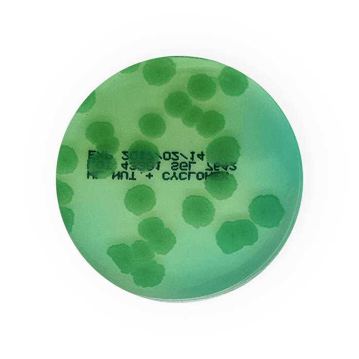 WL Differential Agar (WLD), 55mm Plate Southern Group Laboratory