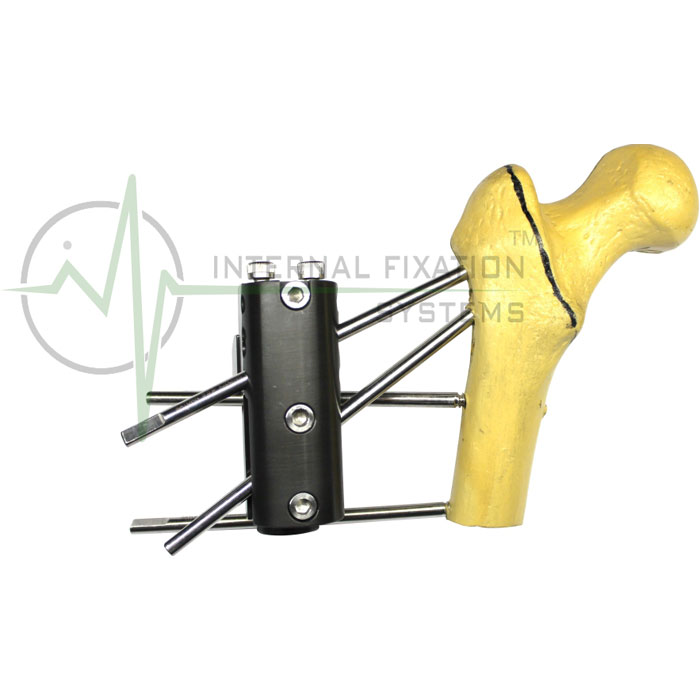 Hip Clamp in Colombia Buy at Wholesale price Shagun Cares
