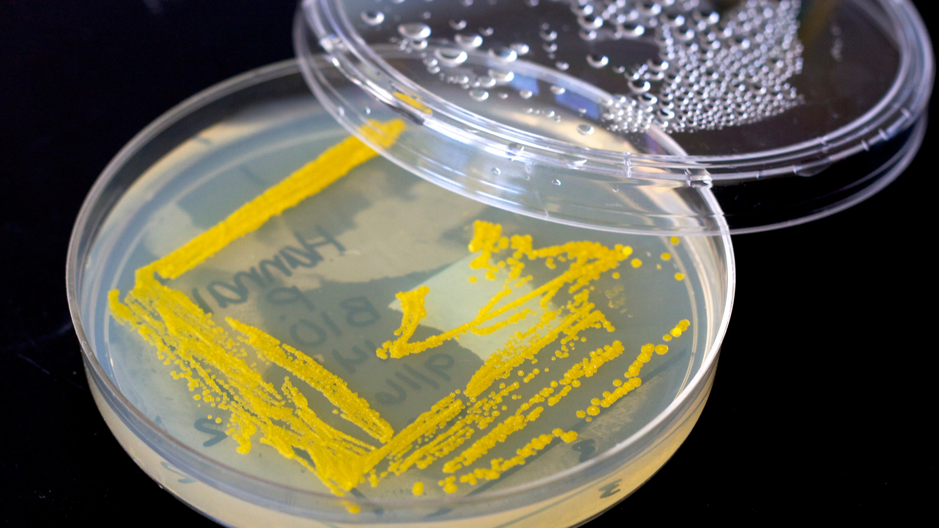 7 Nasty germs that are lurking in your carpet and mattress SheKnows