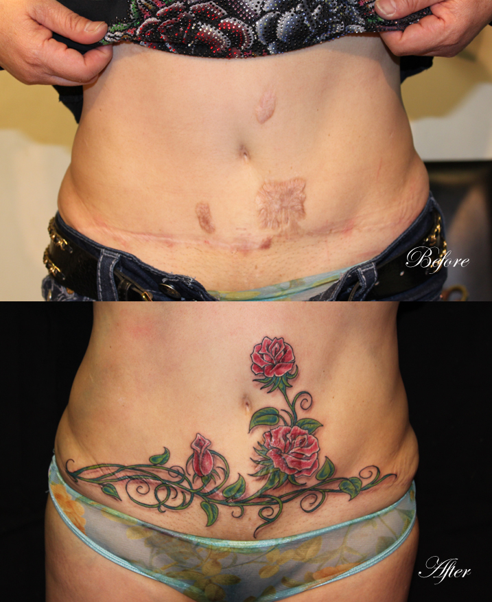 12 Breathtaking C-Section Scar Tattoos – Sheknows 877_x_717_jpg