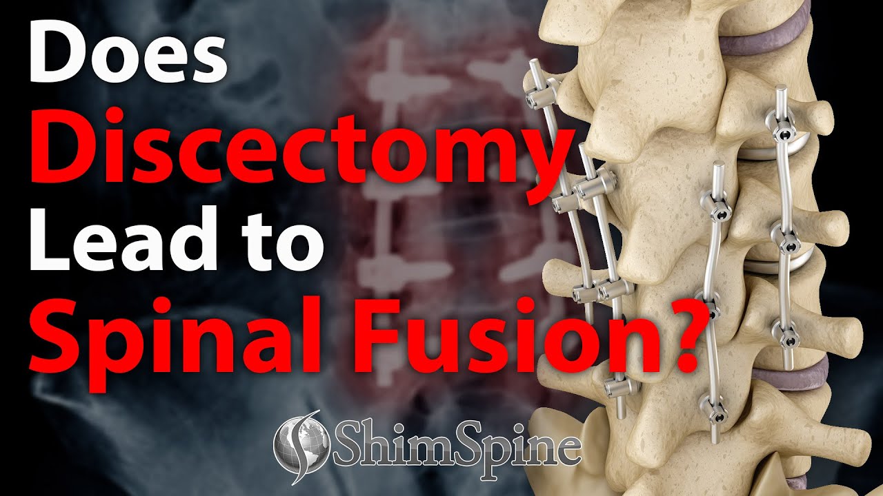 Discectomy Before And After