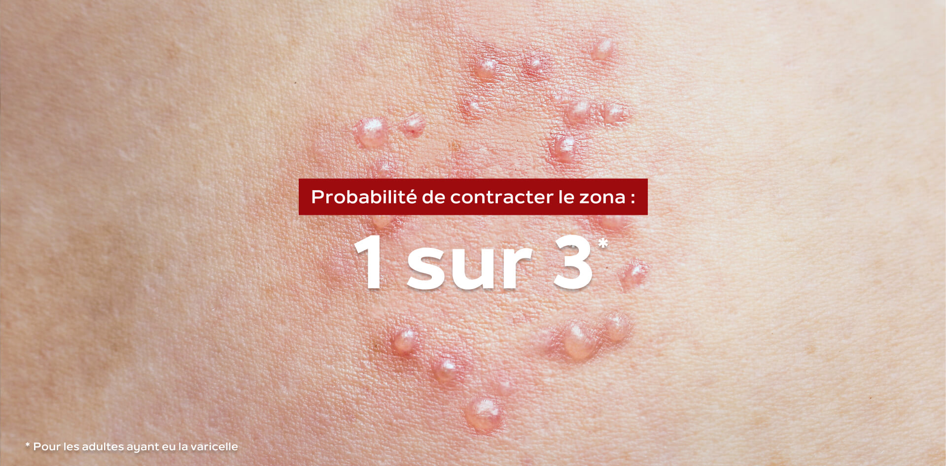 SHINGRIX | Vaccin contre le zona
