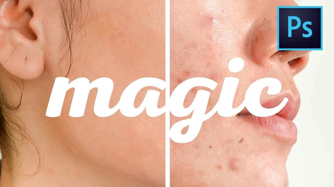 How to Remove Acne/Blemishes in CC ShutterRelease