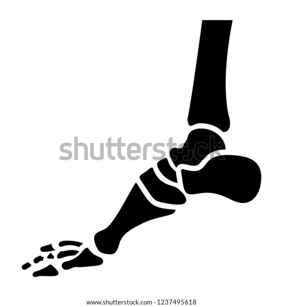 Foot Xray Solid Icon Stock Vector (Royalty Free) 1237495618 Shutterstock