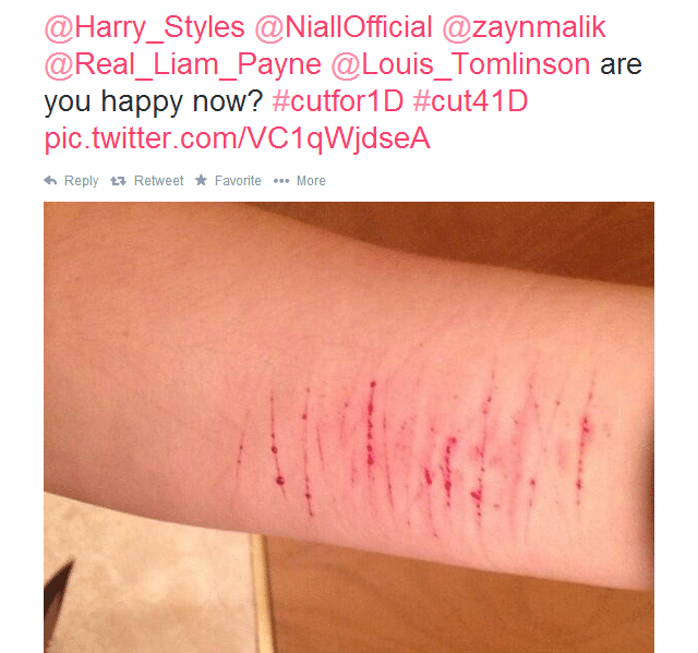 One Direction Fans Are Cutting Themselves After Finding Out The One D