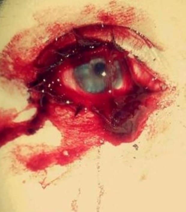 Blood Seeps From This Girl’s Eyes And Ears And Nobody Knows Why Sick