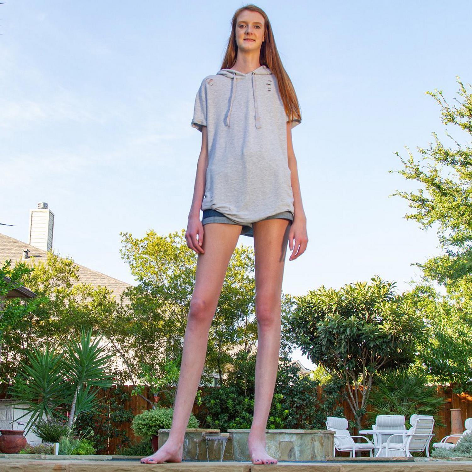Teenager Breaks Record For The World's Longest Legs