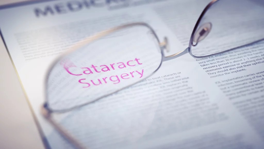 Cataract Surgery Recovery SightMD