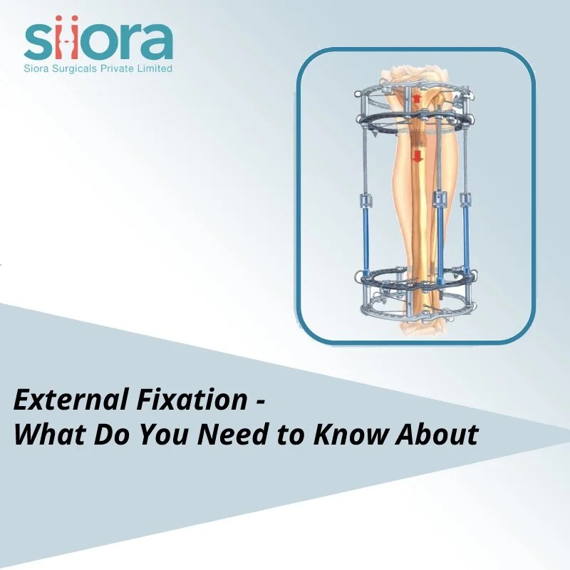External Fixation What Do You Need to Know About Siora Surgicals