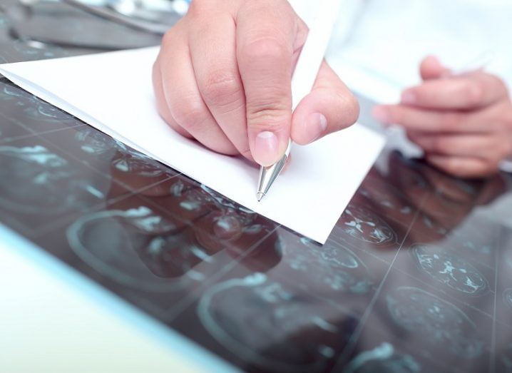 SFI centre signs deal to make monitoring of epilepsy much simpler