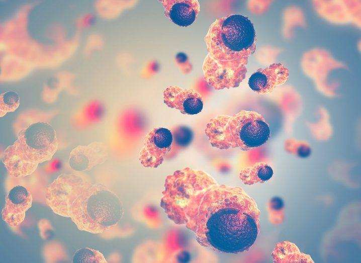 Probe that lights up cancer cells could be gamechanger during surgery