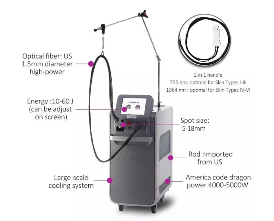 Diode Laser, NdYAG Laser and IPL Laser Comparison