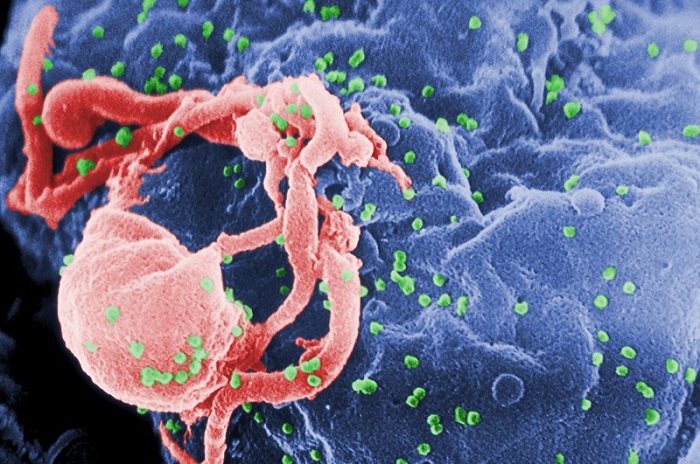 Esta fotografía sin fecha proporcionada por los Centros para el Control y la Prevención de Enfermedades muestra una micrografía electrónica de barrido de múltiples protuberancias redondas del virus VIH-1 en la superficie de una célula. 