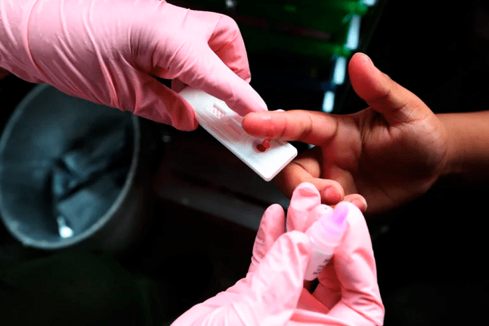 Antes de recibir tratamiento, las personas con la variante VB tenían mucho mayor carga viral en la sangre y sufrían más daño en el sistema inmunitario que los pacientes con otras versiones del VIH.