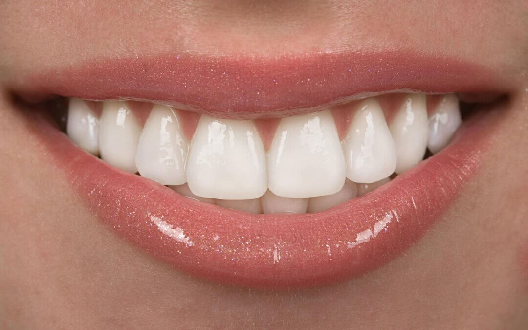 How long does it take to straighten teeth? Valley Dental Practice