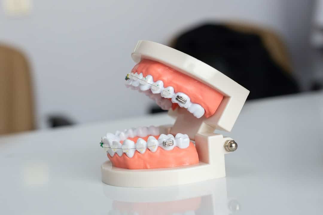 Broken Braces Bracket? How a Round Rock Orthodontist Can Help