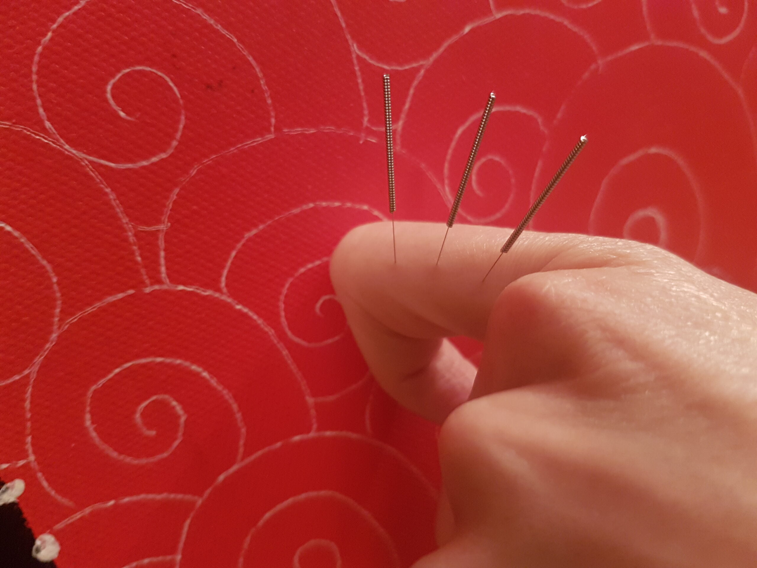 Master Tung's Acupuncture Point 11.08 Zhi Wu Jin+ Zhi Qian Jin סינימד