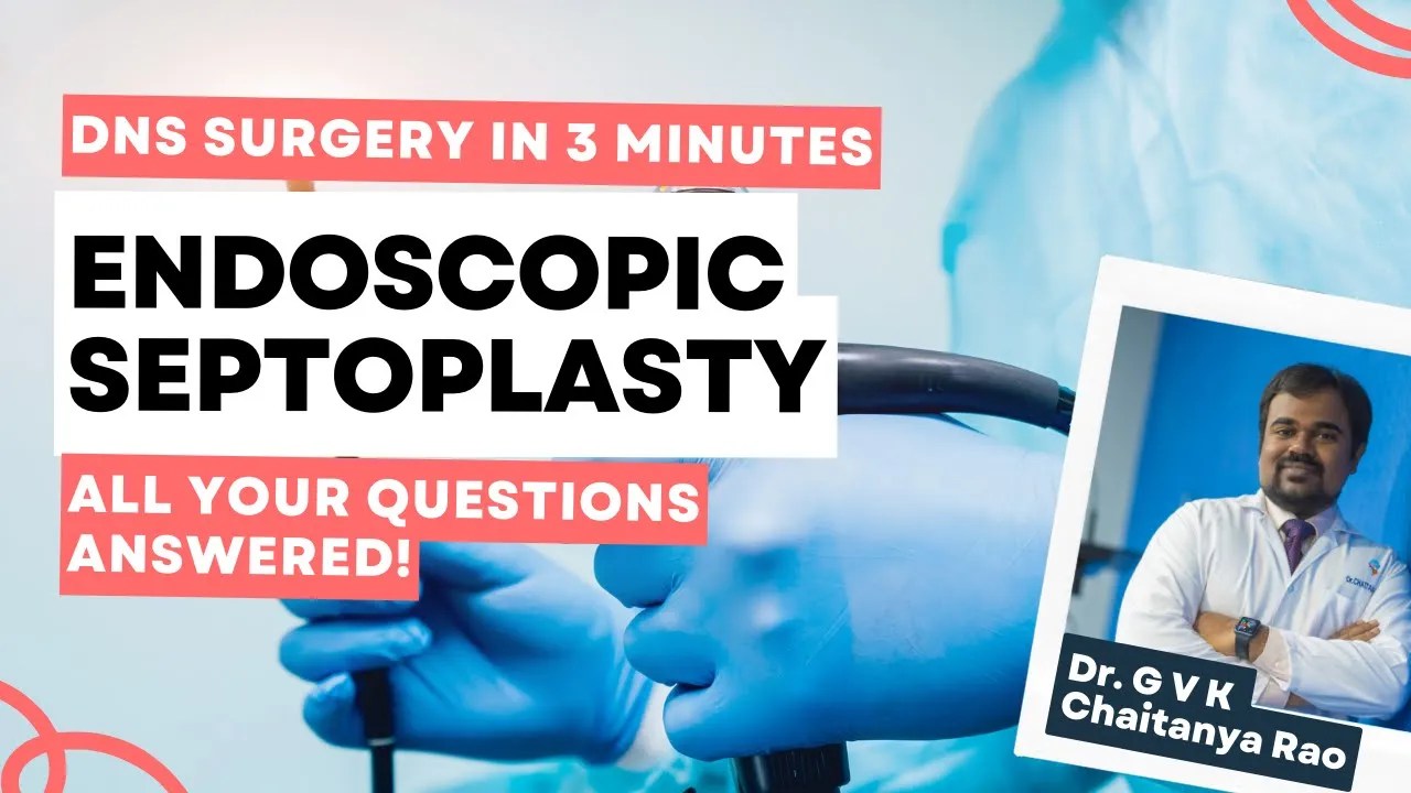 Endoscopic Septoplasty Surgery Deviated septum surgery in 3 minutes