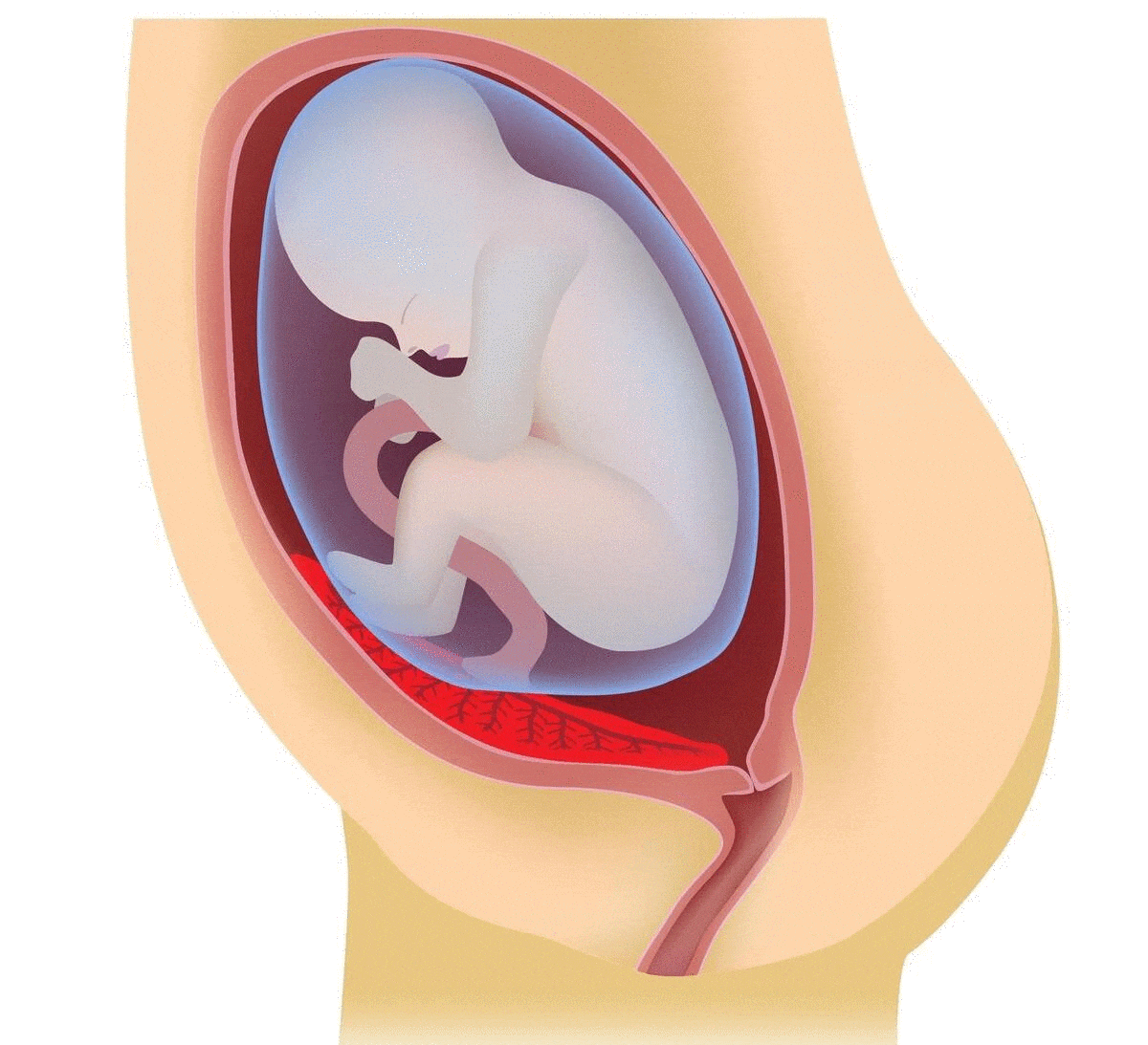 Low Lying Placenta What You Need to Know