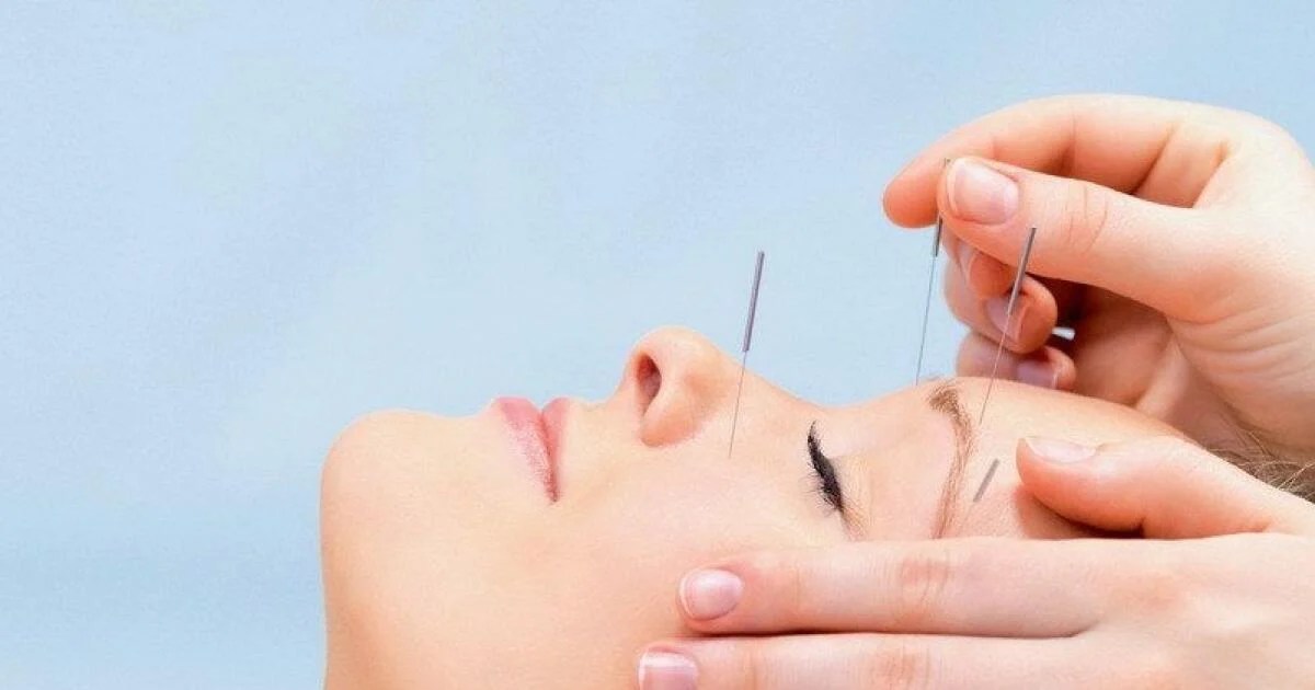 Why Is dry Needling Melbourne so Good For Your Health?