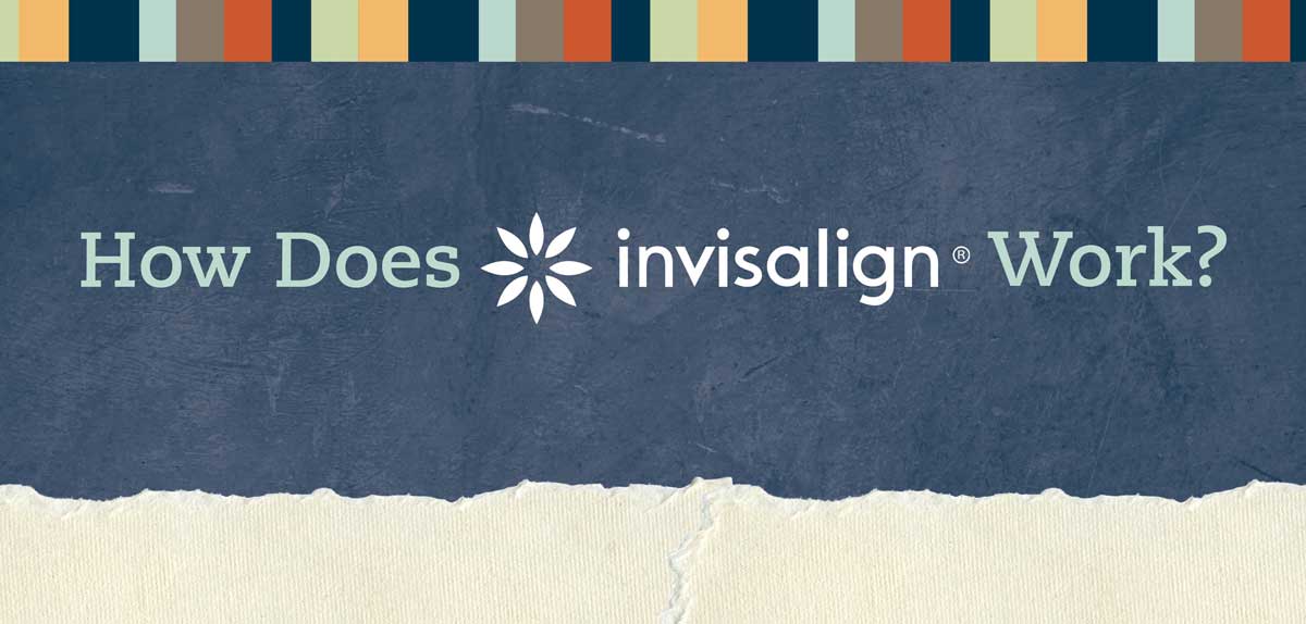 Invisalign How does it work? Skelton Orthodontics