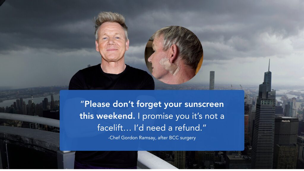 Ung thư da của Gordon Ramsay Tin tức được lan truyền khắp thế giới