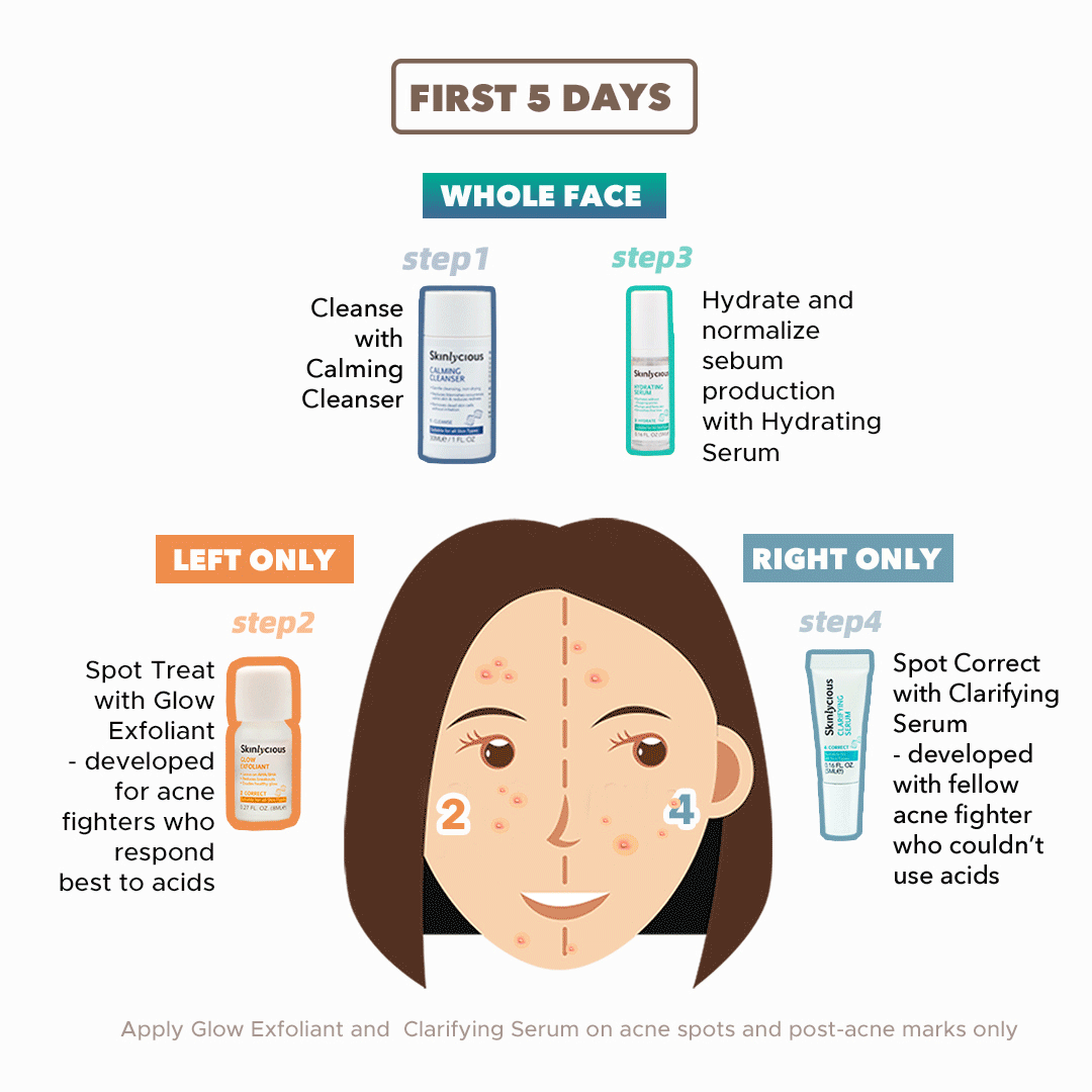 Clear Skin Essentials Starter Kit Skinlycious Gentle Solutions for