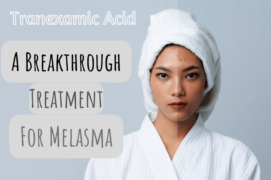Tranexamic Acid The Secret Ingredient For Melasma Treatment