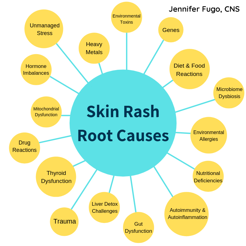 053: 16 Root Causes Driving Skin Rashes (Like Eczema, Psoriasis, Dandruff, Rosacea & More)