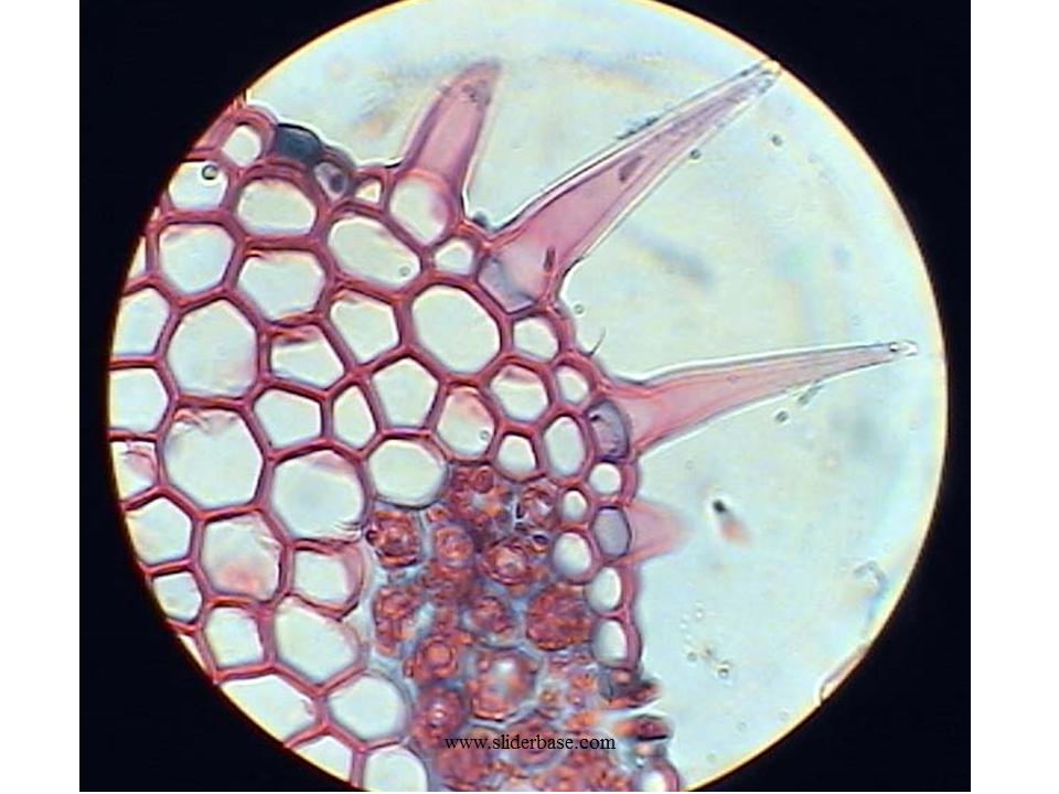 Xerophytes Presentation Health and Disease