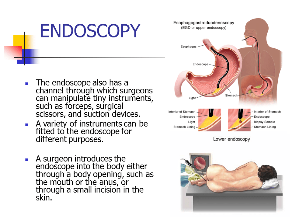 Endoscopy Presentation Biology
