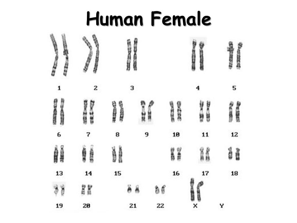 Karyotypes Presentation Biology
