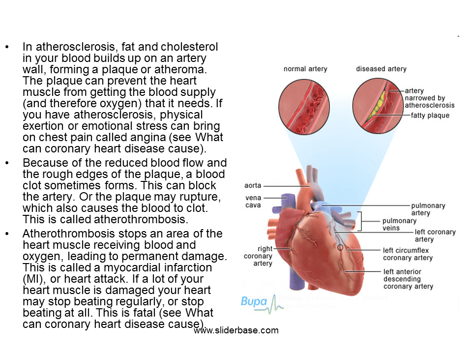 Coronary heart disease Presentation Health and Disease