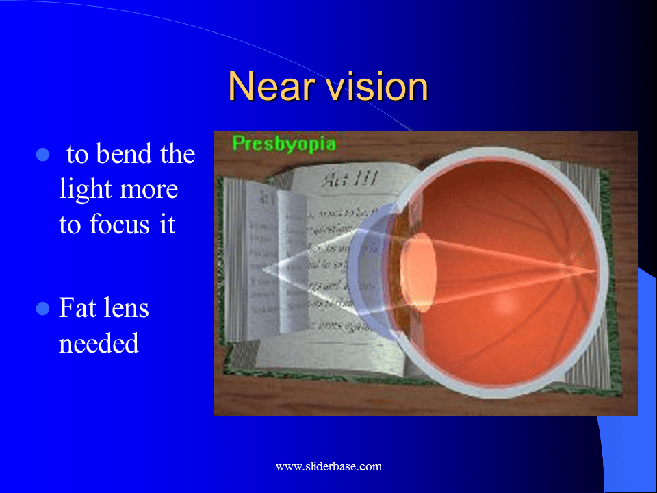 Eye Presentation Health and Disease