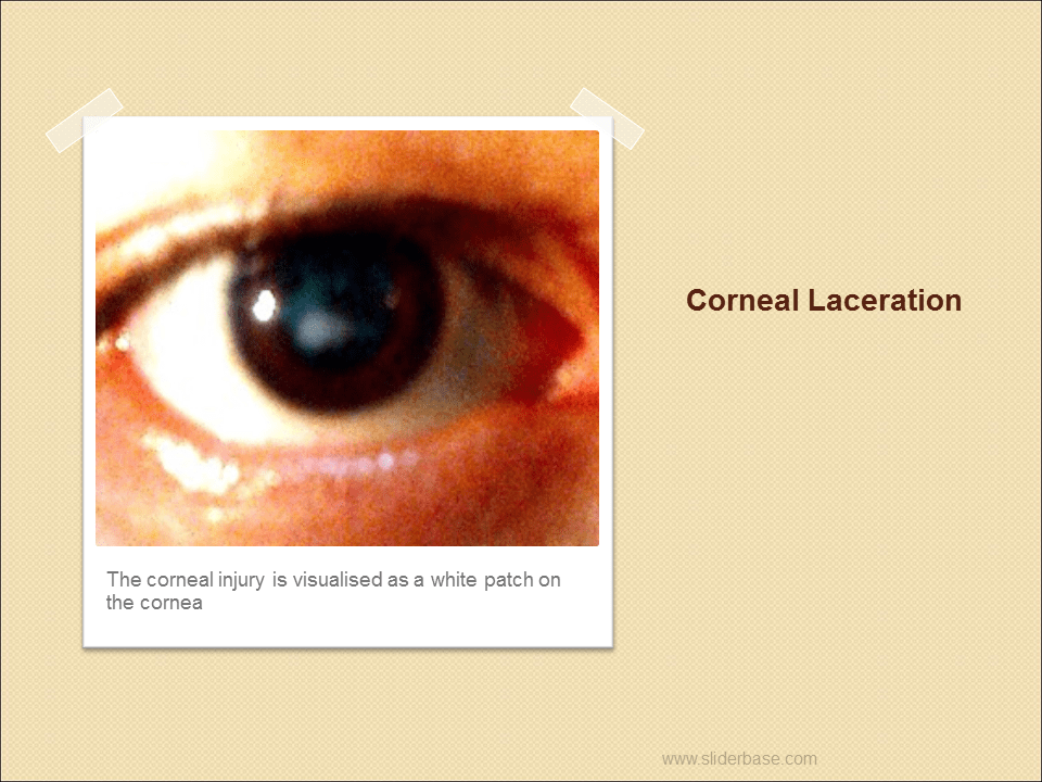 The Eye Presentation Health and Disease